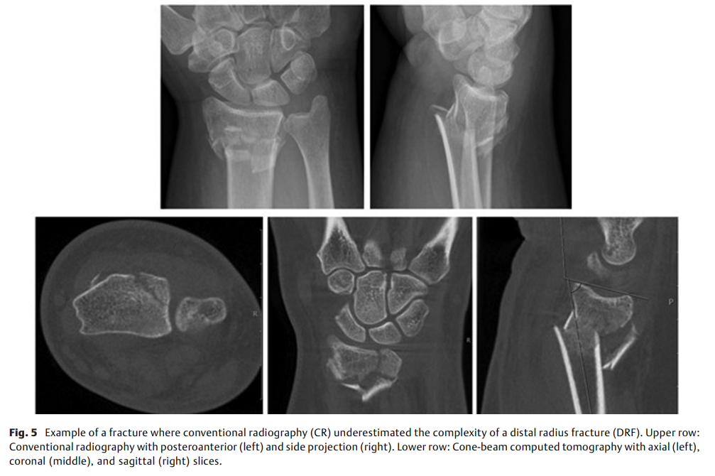 Cone-Beam Computed Tomography.png