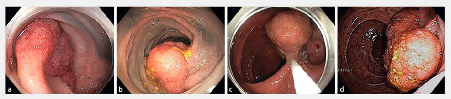 屏幕截图 2026-03-16 105321.png