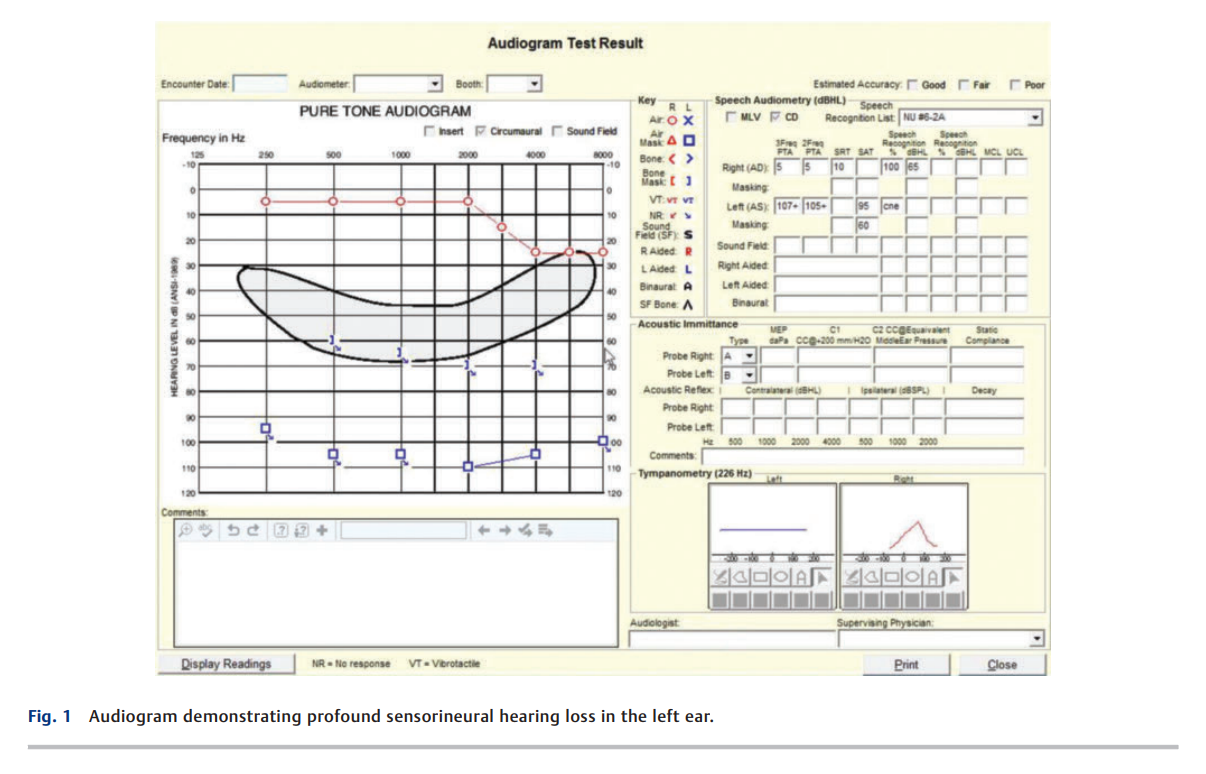 Vestibular Dysfunction 2.png