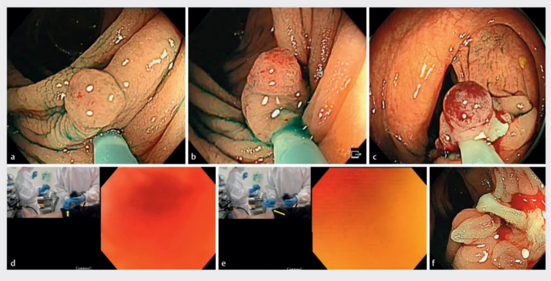 69c0989d87779.png 屏幕截图 2026-03-23 084505.png