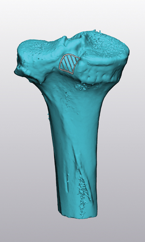 10-1055-s-0041-1741430-i210059oa-1.jpg