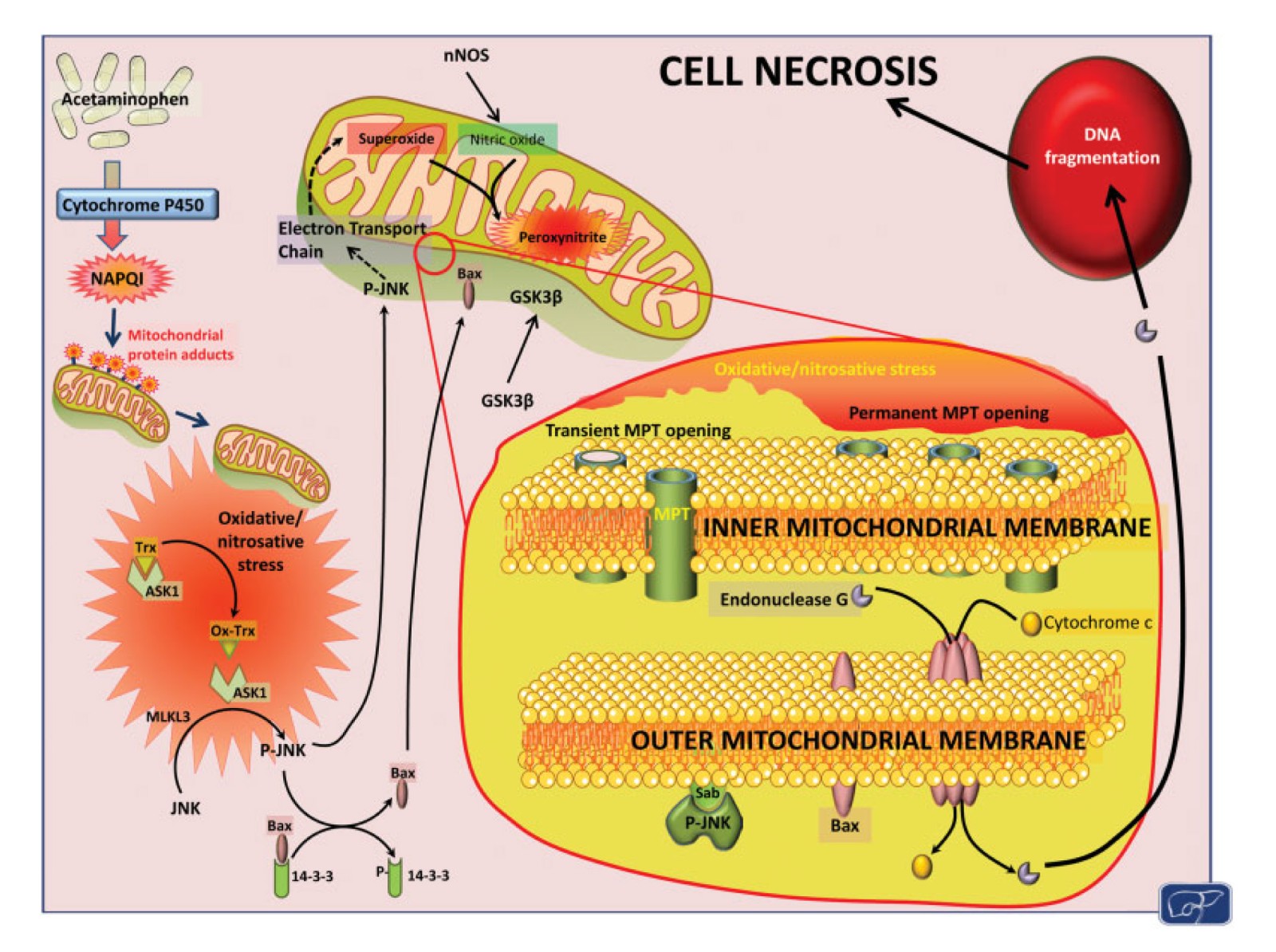 Acetaminophen Hepatotoxicity-5.jpg