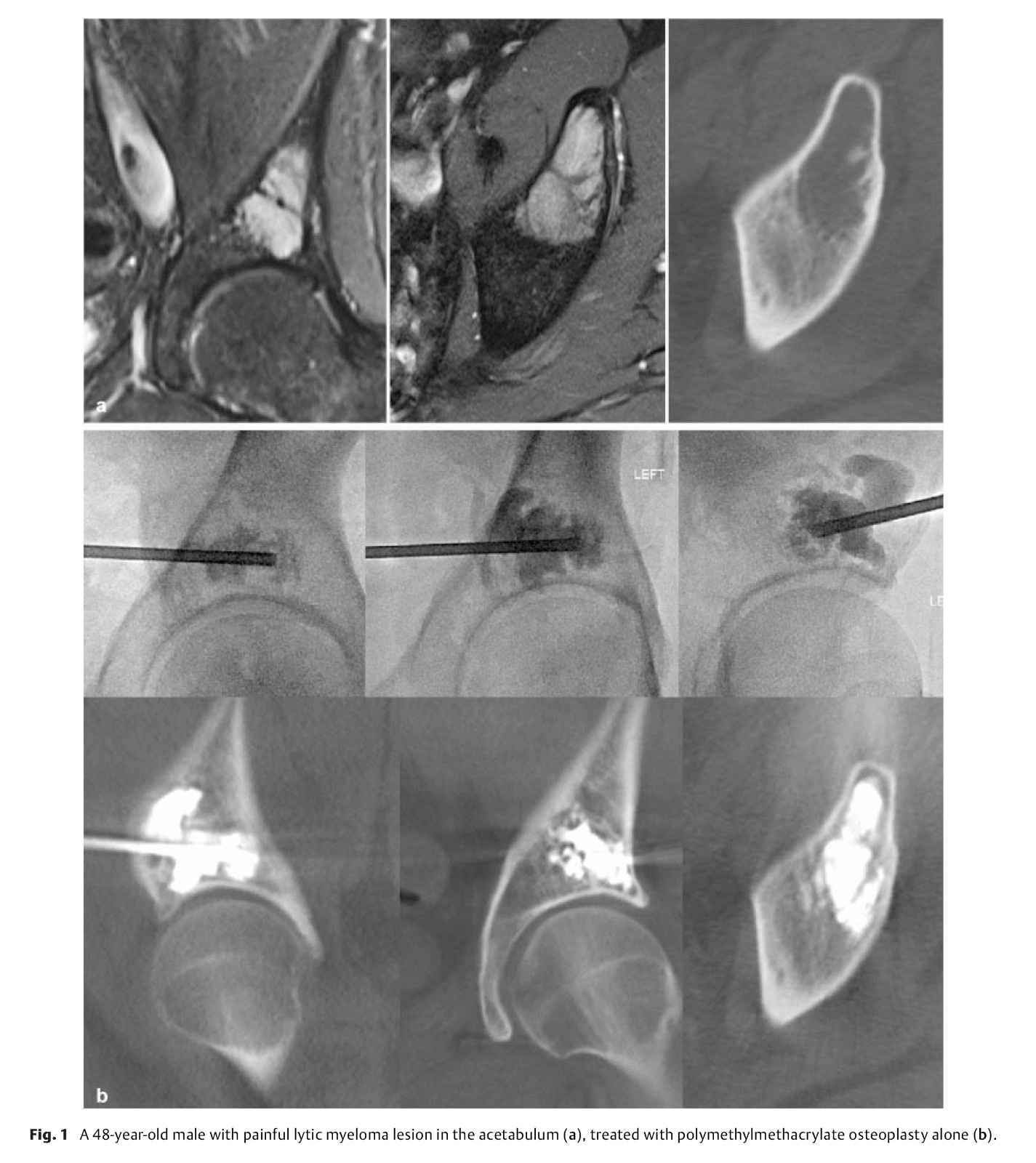 Minimally Invasive Stabilization-3.jpg