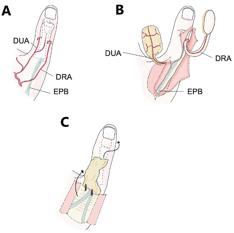 10-1055-s-0042-1758671-i2210139-2.jpg