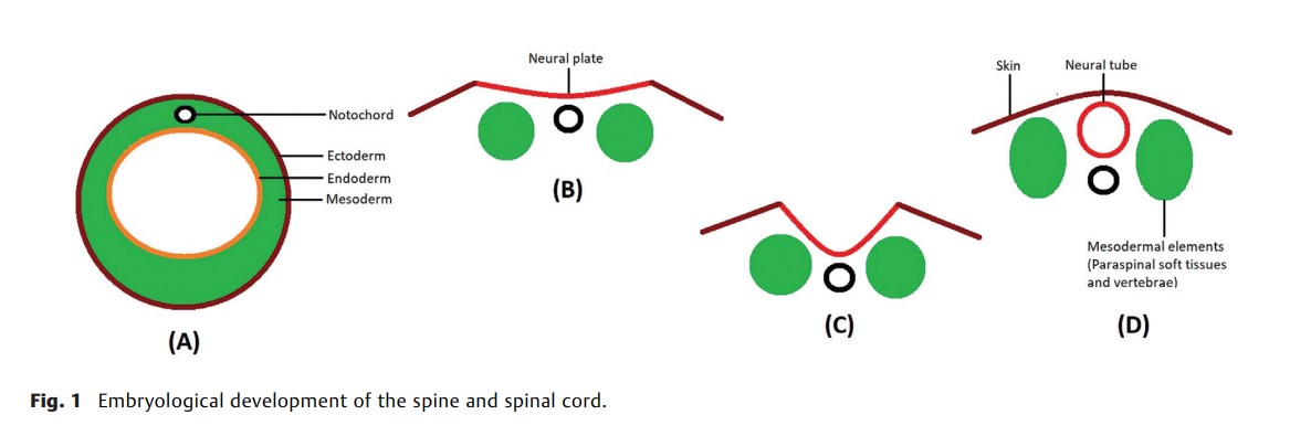 Spinal Dysraphism Spectrum.jpg