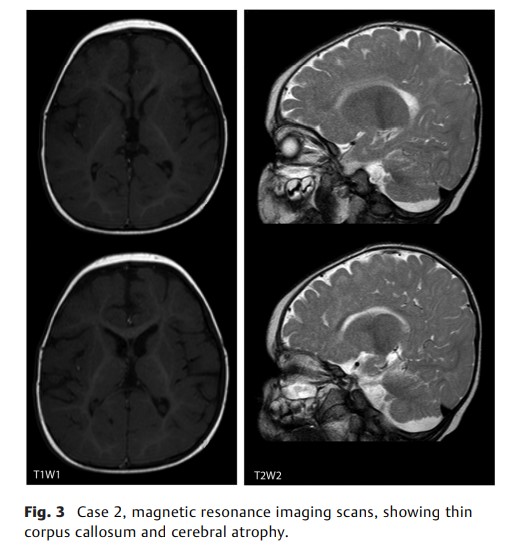 First Clinical Report of.jpg
