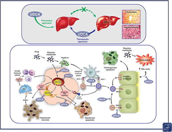 UDCA for Drug-Induced Liver Disease.jpg