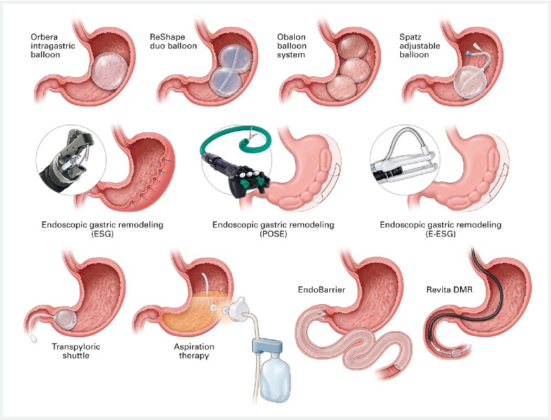 American Society for Gastrointestina.jpg
