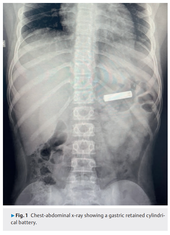 屏幕截图 2025-02-27 161243.png