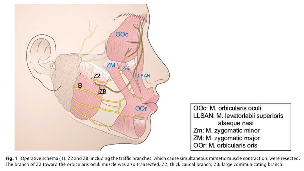 Selective Neurectomy 2.png