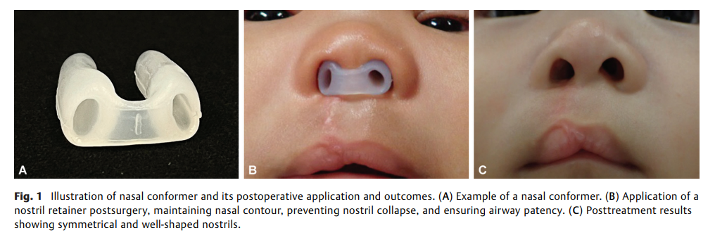 The Effectiveness of Nasal Conformers 2.png
