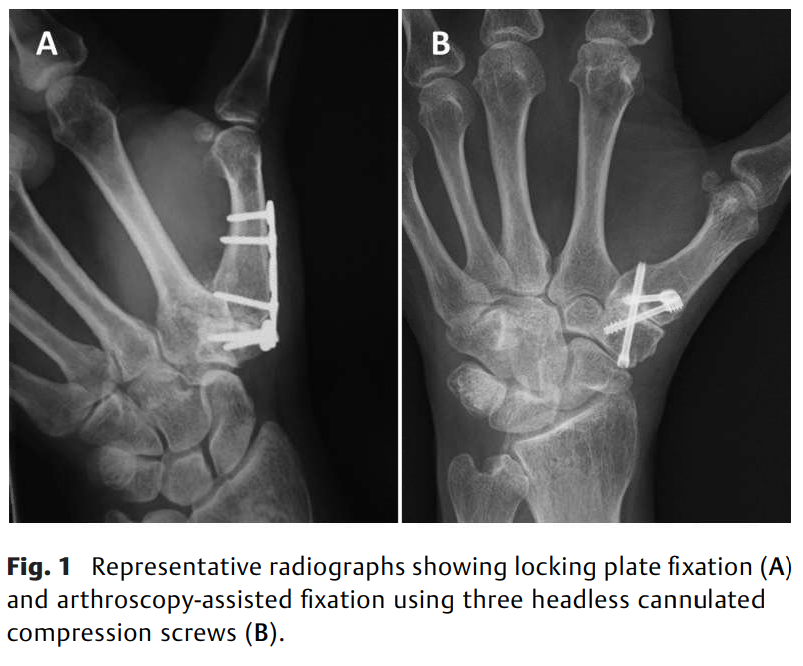 How does Fixation Alignment .png