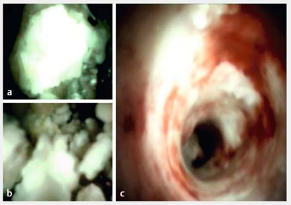 695b2546a9126.png 1.png