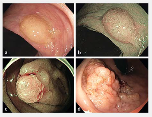 69ae3a584365f.png 屏幕截图 2026-03-09 101522.png