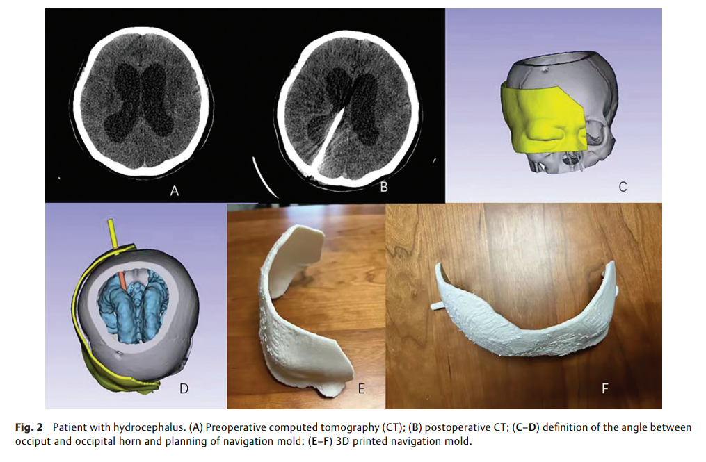 1-The Application 2.png