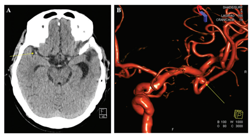屏幕截图 2026-04-02 112211.png