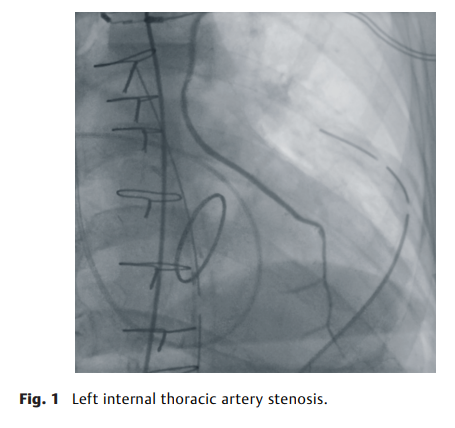 屏幕截图 2026-04-02 113837.png