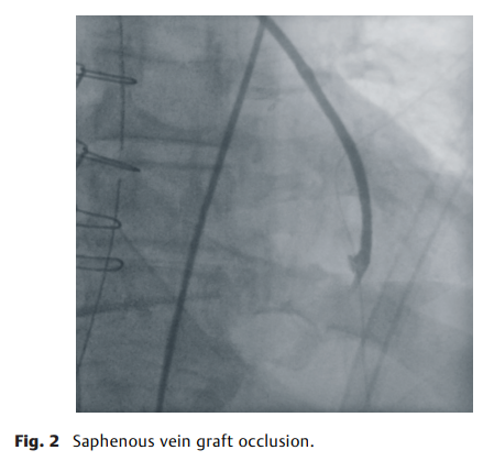 屏幕截图 2026-04-02 113847.png