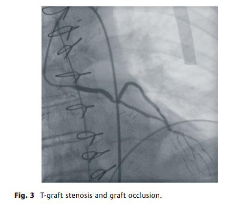 屏幕截图 2026-04-02 113855.png