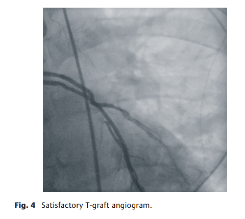 屏幕截图 2026-04-02 113905.png