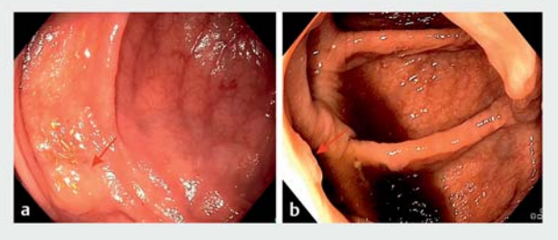 屏幕截图 2026-04-08 172337.png
