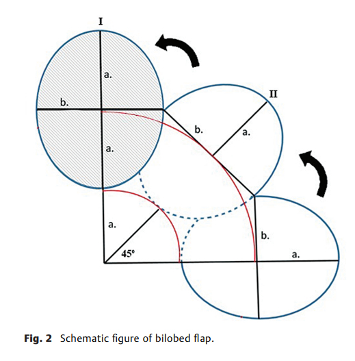 Domino Flap Using Bilobed 2.png