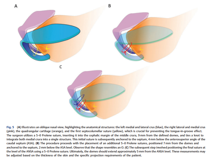 Enhancing Nasal Tip 2.png