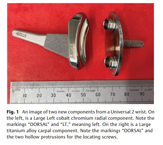 6a0eb149d6fcf.png Failure of Universal 2 Wrist Joint .png
