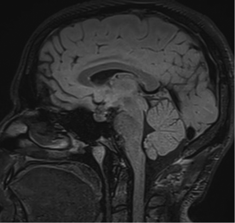 10-1055-s-0041-1725959-i202959cr-3.jpg